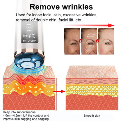 Mini Dispositivo HIFU Facial para Lifting Masajeador Facial con Microcorriente para la Piel