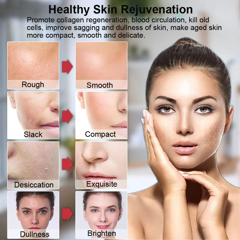 Mini Dispositivo HIFU Facial para Lifting Masajeador Facial con Microcorriente para la Piel