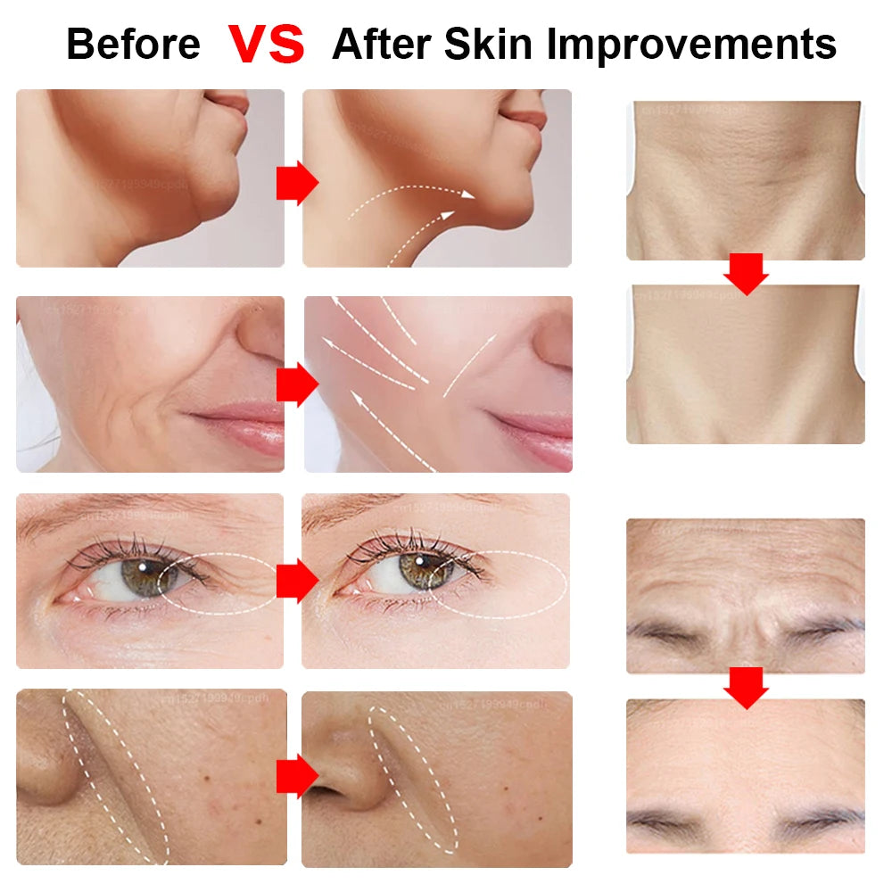 Mini Dispositivo HIFU Facial para Lifting Masajeador Facial con Microcorriente para la Piel