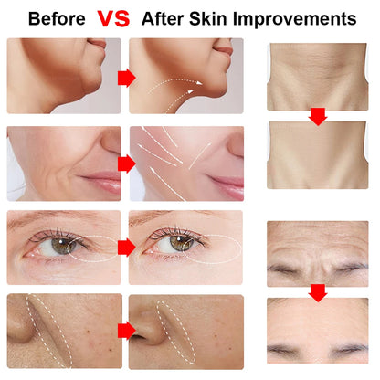 Mini Dispositivo HIFU Facial para Lifting Masajeador Facial con Microcorriente para la Piel